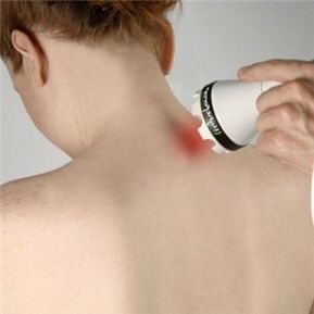 zdravljenje osteohondroze materničnega vratu
