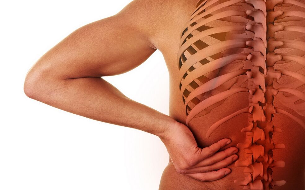 bolečine v hrbtu zaradi osteohondroze