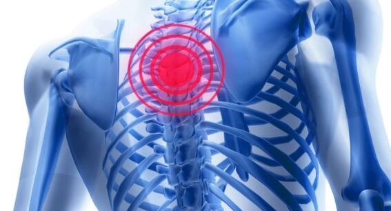 Zdravljenje osteohondroze torakalne hrbtenice