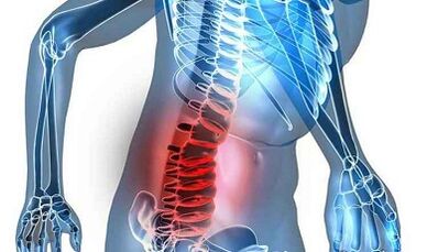 Znaki in simptomi ledvene osteohondroze