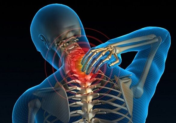 bolečine v vratu zaradi osteohondroze