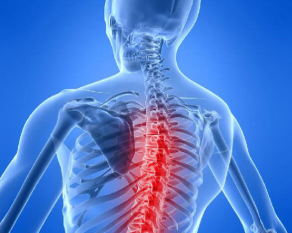 Osteochondrosis hrbtenice